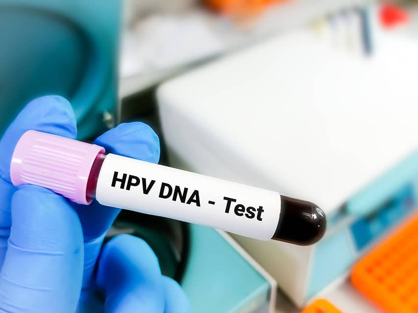 HPV - DNA Test